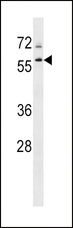 TBL1XR1 / TBLR1 Antibody - TBL1XR1 Antibody western blot of K562 cell line lysates (35 ug/lane). The TBL1XR1 antibody detected the TBL1XR1 protein (arrow).