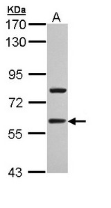 TBL1XR1 / TBLR1 Antibody - Sample (30 ug of whole cell lysate). A: A431 . 7.5% SDS PAGE. TBL1XR1 / TBLR1 antibody diluted at 1:1000.