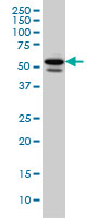 TBL1XR1 / TBLR1 Antibody - TBL1XR1 monoclonal antibody (M01), clone 3G7 Western blot of TBL1XR1 expression in HeLa.