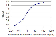 TBL1XR1 / TBLR1 Antibody - Detection limit for recombinant GST tagged TBL1XR1 is 0.03 ng/ml as a capture antibody.
