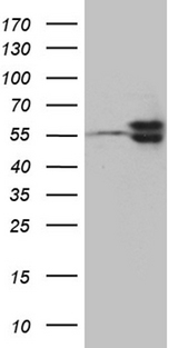 TBL1XR1 / TBLR1 Antibody - HEK293T cells were transfected with the pCMV6-ENTRY control. (Left lane) or pCMV6-ENTRY TBL1XR1. (Right lane) cDNA for 48 hrs and lysed. Equivalent amounts of cell lysates. (5 ug per lane) were separated by SDS-PAGE and immunoblotted with anti-TBL1XR1. (1:2000)