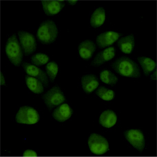 TBL1XR1 / TBLR1 Antibody - Immunocytochemistry staining of HeLa cells fixed with 4% Paraformaldehyde and using TBLR1 mouse monoclonal antibody (dilution 1:200).