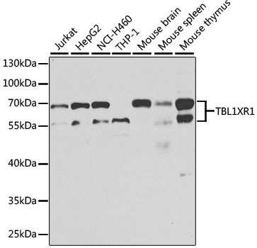 TBL1XR1 / TBLR1 Antibody - Western blot analysis of extracts of various cell lines, using TBL1XR1 antibody at 1:1000 dilution. The secondary antibody used was an HRP Goat Anti-Rabbit IgG (H+L) at 1:10000 dilution. Lysates were loaded 25ug per lane and 3% nonfat dry milk in TBST was used for blocking. An ECL Kit was used for detection and the exposure time was 10s.