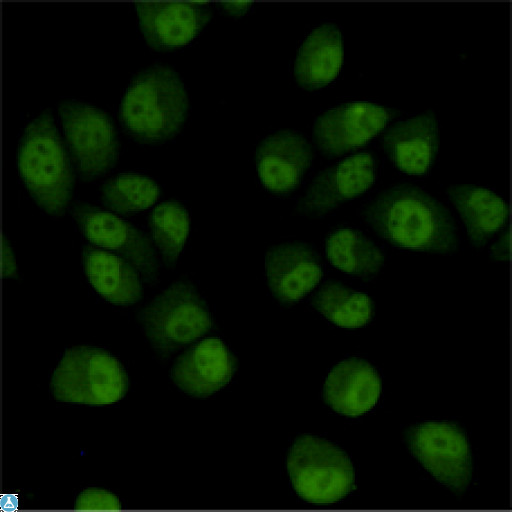 TBL1XR1 / TBLR1 Antibody - Immunocytochemistry staining of HeLa cells fixed with 4% Paraformaldehyde and using TBLR1 mouse mAb (dilution 1:200).