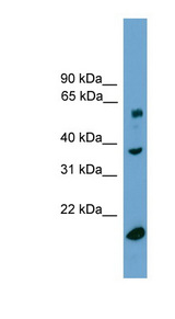TBL1Y / TBL1 Antibody - TBL1Y antibody Western blot of Fetal Lung lysate. This image was taken for the unconjugated form of this product. Other forms have not been tested.