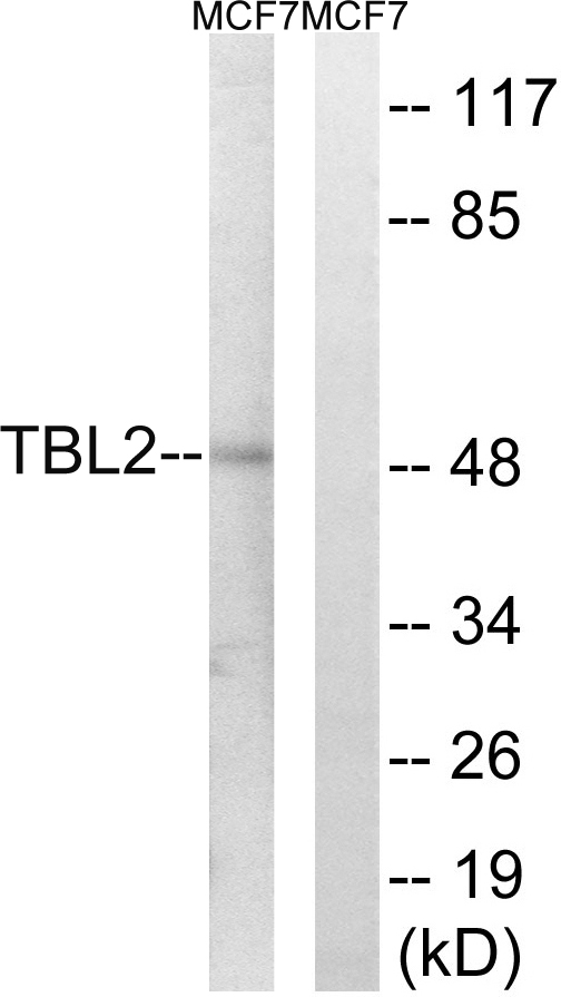 TBL2 Antibody - Western blot analysis of lysates from MCF-7 cells, using TBL2 Antibody. The lane on the right is blocked with the synthesized peptide.