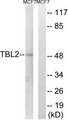 TBL2 Antibody - Western blot analysis of lysates from MCF-7 cells, using TBL2 Antibody. The lane on the right is blocked with the synthesized peptide.
