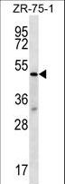 TBL2 Antibody - TBL2 Antibody western blot of ZR-75-1 cell line lysates (35 ug/lane). The TBL2 antibody detected the TBL2 protein (arrow).