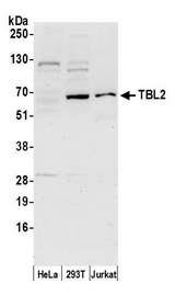 TBL2 Antibody - Detection of human TBL2 by western blot. Samples: Whole cell lysate (50 µg) from HeLa, HEK293T, and Jurkat cells prepared using NETN lysis buffer. Antibody: Affinity purified rabbit anti-TBL2 antibody used for WB at 1 µg/ml. Detection: Chemiluminescence with an exposure time of 30 seconds.
