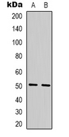 TBL2 Antibody - Western blot analysis of TBL2 expression in Ramos (A); MCF7 (B) whole cell lysates.