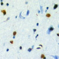 TBL2 Antibody - Immunohistochemical analysis of TBL2 staining in human brain formalin fixed paraffin embedded tissue section. The section was pre-treated using heat mediated antigen retrieval with sodium citrate buffer (pH 6.0). The section was then incubated with the antibody at room temperature and detected with HRP and DAB as chromogen. The section was then counterstained with hematoxylin and mounted with DPX.