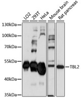 TBL2 Antibody - Western blot analysis of extracts of various cell lines, using TBL2 antibody at 1:1000 dilution. The secondary antibody used was an HRP Goat Anti-Rabbit IgG (H+L) at 1:10000 dilution. Lysates were loaded 25ug per lane and 3% nonfat dry milk in TBST was used for blocking. An ECL Kit was used for detection and the exposure time was 90s.