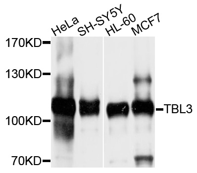 TBL3 Antibody - Western blot analysis of extracts of various cell lines, using TBL3 antibody at 1:1000 dilution. The secondary antibody used was an HRP Goat Anti-Rabbit IgG (H+L) at 1:10000 dilution. Lysates were loaded 25ug per lane and 3% nonfat dry milk in TBST was used for blocking. An ECL Kit was used for detection and the exposure time was 10s.