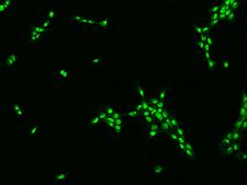 TBL3 Antibody - Immunofluorescence staining of TBL3 in A431 cells. Cells were fixed with 4% PFA, permeabilzed with 0.1% Triton X-100 in PBS, blocked with 10% serum, and incubated with rabbit anti-Human TBL3 polyclonal antibody (dilution ratio 1:200) at 4°C overnight. Then cells were stained with the Alexa Fluor 488-conjugated Goat Anti-rabbit IgG secondary antibody (green). Positive staining was localized to Nucleus.