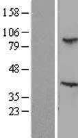 TBL3 Protein - Western validation with an anti-DDK antibody * L: Control HEK293 lysate R: Over-expression lysate