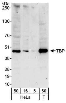 TBP / GTF2D Antibody - Detection of Human TBP by Western Blot. Samples: Whole cell lysate from HeLa (5, 15 and 50 ug) and 293T (T; 50 ug) cells. Antibody: Affinity purified rabbit anti-TBP antibody used for WB at 1 ug/ml. Detection: Chemiluminescence with an exposure time of 30 seconds.