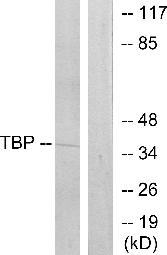 TBP / GTF2D Antibody - Western blot analysis of lysates from 293 cells, using TBP Antibody. The lane on the right is blocked with the synthesized peptide.