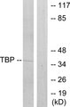 TBP / GTF2D Antibody - Western blot analysis of lysates from 293 cells, using TBP Antibody. The lane on the right is blocked with the synthesized peptide.