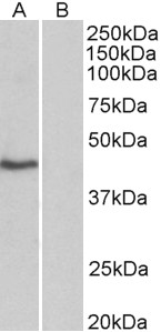 TBP / GTF2D Antibody - TBP antibody (0.3 ug/ml) staining of HeLa nuclear (A) and cytosolic (B) lysates (35 ug protein in commercial extraction buffer). Primary incubation was 1 hour. Detected by chemiluminescence.
