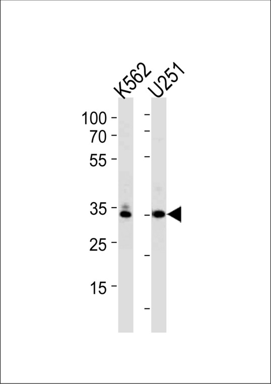 TBP / GTF2D Antibody - TBP Antibody western blot of K562,U251 cell line lysates (35 ug/lane). The TBP antibody detected the TBP protein (arrow).