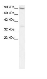TBP / GTF2D Antibody - Placenta Lysate.  This image was taken for the unconjugated form of this product. Other forms have not been tested.