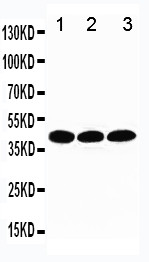 TBP / GTF2D Antibody - WB of TBP antibody. All lanes: Anti-TBP at 0.5ug/ml. Lane 1: MCF-7 Whole Cell Lysate at 40ug. Lane 2: MM231 Whole Cell Lysate at 40ug. Lane 3: MM231 Whole Cell Lysate at 40ug. Predicted bind size: 38KD. Observed bind size: 38KD.