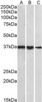 TBP / GTF2D Antibody - Goat Anti-TBP /Transcription factor IID (aa39-50) Antibody (1µg/ml) staining of cell line NIH3T3 (A), Mouse Testis (B) and Rat Testis (C) lysates (35µg protein in RIPA buffer). Primary incubation was 1 hour. Detected by chemiluminescencence