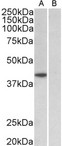 TBP / GTF2D Antibody - TBP antibody (1 ug/ml) staining of HeLa nuclear (A) and cytosolic (B) lysates (35 ug protein in RIPA buffer). Primary incubation was 1 hour. Detected by chemiluminescence.