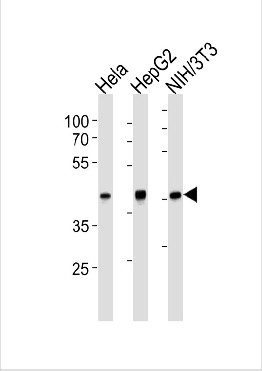 TBP / GTF2D Antibody - TBP Antibody western blot of HeLa,HepG2,mouse NIH/3T3 cell line lysates (35 ug/lane). The TBP antibody detected the TBP protein (arrow).