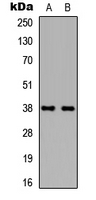 TBP / GTF2D Antibody - Western blot analysis of TBP expression in HEK293T (A); NIH3T3 (B) whole cell lysates.