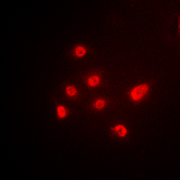 TBP / GTF2D Antibody - Immunofluorescent analysis of TBP staining in HEK293T cells. Formalin-fixed cells were permeabilized with 0.1% Triton X-100 in TBS for 5-10 minutes and blocked with 3% BSA-PBS for 30 minutes at room temperature. Cells were probed with the primary antibody in 3% BSA-PBS and incubated overnight at 4 deg C in a humidified chamber. Cells were washed with PBST and incubated with a DyLight 594-conjugated secondary antibody (red) in PBS at room temperature in the dark. DAPI was used to stain the cell nuclei (blue).