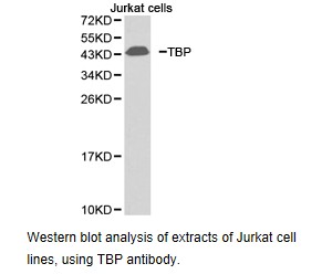TBP / GTF2D Antibody - Western blot.