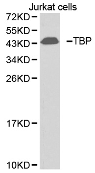 TBP / GTF2D Antibody - Western blot analysis of extracts of Jurkat cell lines.