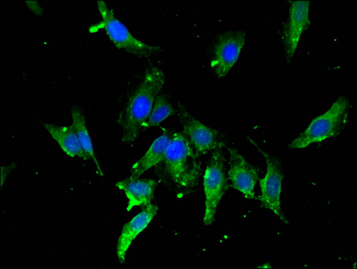 TBP / GTF2D Antibody - Immunofluorescent analysis of Hela cells using TBP Antibody at a dilution of 1:100 and Alexa Fluor 488-congugated AffiniPure Goat Anti-Rabbit IgG(H+L)