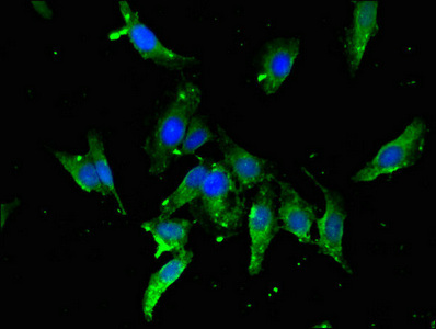 TBP / GTF2D Antibody - Immunofluorescent analysis of Hela cells using TBP Antibody at dilution of 1:100 and Alexa Fluor 488-congugated AffiniPure Goat Anti-Rabbit IgG(H+L)