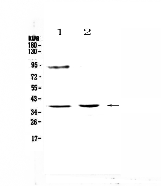 TBP / GTF2D Antibody - Western blot - Anti-Tbp/Tata Binding Protein Tbp Picoband antibody