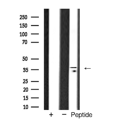 TBP / GTF2D Antibody - Western blot analysis of TBP expression in HeLa cells
