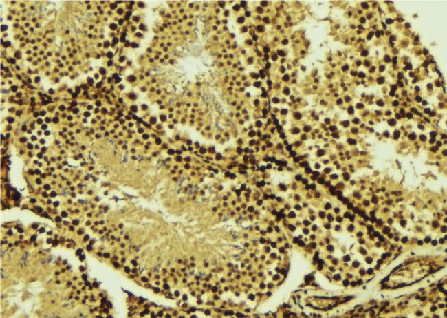 TBP / GTF2D Antibody - 1:100 staining mouse testis tissue by IHC-P. The sample was formaldehyde fixed and a heat mediated antigen retrieval step in citrate buffer was performed. The sample was then blocked and incubated with the antibody for 1.5 hours at 22°C. An HRP conjugated goat anti-rabbit antibody was used as the secondary.