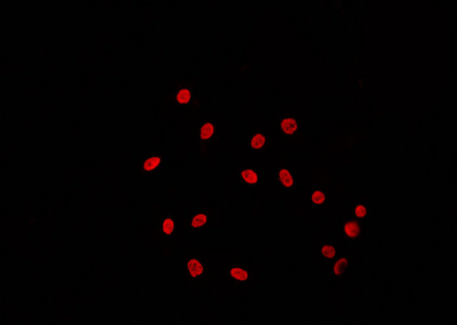 TBP / GTF2D Antibody - Staining 293 cells by IF/ICC. The samples were fixed with PFA and permeabilized in 0.1% Triton X-100, then blocked in 10% serum for 45 min at 25°C. The primary antibody was diluted at 1:200 and incubated with the sample for 1 hour at 37°C. An Alexa Fluor 594 conjugated goat anti-rabbit IgG (H+L) Ab, diluted at 1/600, was used as the secondary antibody.