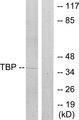 TBP / GTF2D Antibody - Western blot analysis of extracts from 293 cells, using TBP antibody.