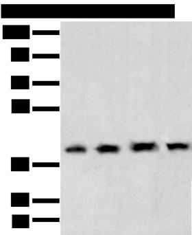 TBP / GTF2D Antibody - Western blot analysis of 231 cell Human testis tissue Hela and Hepg2 cell  using TBP Polyclonal Antibody at dilution of 1:400