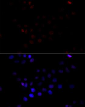 TBP / GTF2D Antibody - Immunofluorescence analysis of HeLa cells using TBP Polyclonal Antibody at dilution of 1:100 (40x lens).Blue: DAPI for nuclear staining.