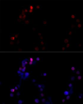 TBP / GTF2D Antibody - Immunofluorescence analysis of NIH/3T3 cells using TBP Polyclonal Antibody at dilution of 1:100 (40x lens).Blue: DAPI for nuclear staining.
