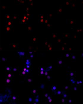 TBP / GTF2D Antibody - Immunofluorescence analysis of PC12 cells using TBP Polyclonal Antibody at dilution of 1:100 (40x lens).Blue: DAPI for nuclear staining.