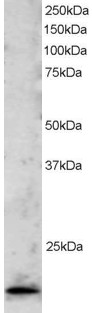 TBPL1 / TRF2 Antibody - Antibody staining (2 ug/ml) of Jurkat lysate (RIPA buffer, 30 ug total protein per lane). Primary incubated for 1 hour. Detected by Western blot of chemiluminescence.