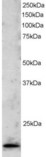 TBPL1 / TRF2 Antibody - Antibody staining (2 ug/ml) of Jurkat lysate (RIPA buffer, 30 ug total protein per lane). Primary incubated for 1 hour. Detected by Western blot of chemiluminescence.