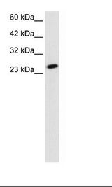 TBPL1 / TRF2 Antibody - HepG2 Cell Lysate.  This image was taken for the unconjugated form of this product. Other forms have not been tested.