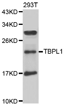 TBPL1 / TRF2 Antibody - Western blot analysis of extracts of 293T cells.