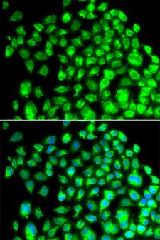 TBPL1 / TRF2 Antibody - Immunofluorescence analysis of A549 cells.