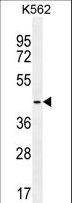 TBPL2 / TRF3 Antibody - TBPL2 Antibody western blot of K562 cell line lysates (35 ug/lane). The TBPL2 antibody detected the TBPL2 protein (arrow).